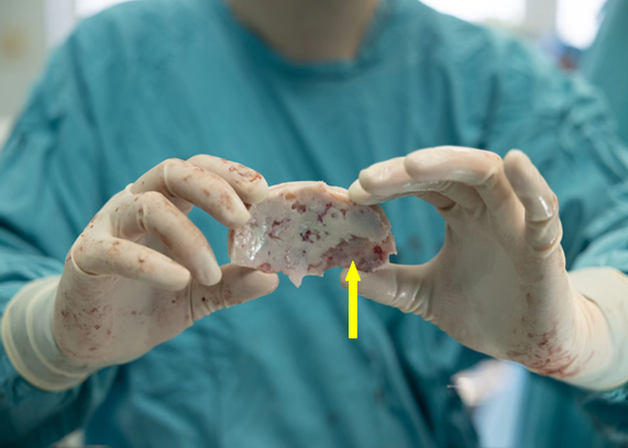 多學(xué)科合作--整形外科與神經(jīng)外科